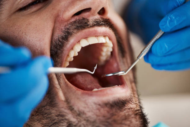 Best Emergency Dentist for Knocked-Out Tooth in St George, MO