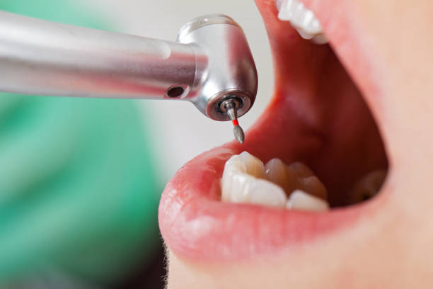 Best Mobile Emergency Dentist in St George, MO